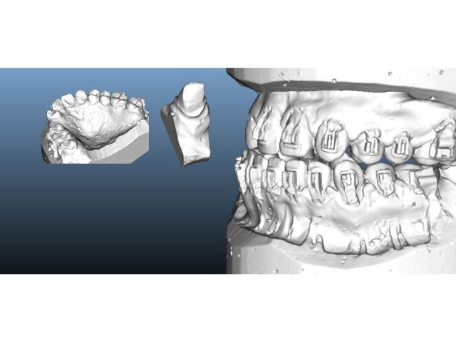 全自動高精度3D掃瞄系統-