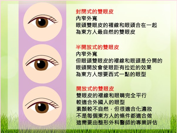 台北雙眼皮手術-